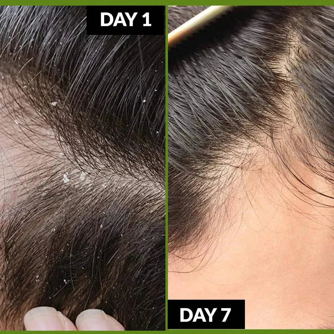 Strength & Fall Control Shampoo: B5 + Biotin, 95% Less Hair Fall